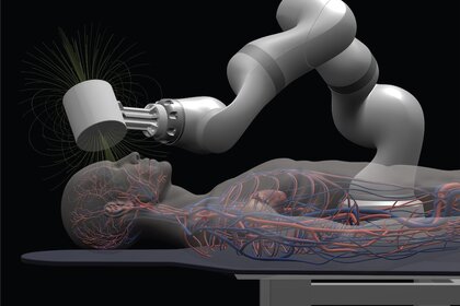 Telerobotic Surgery Illustration