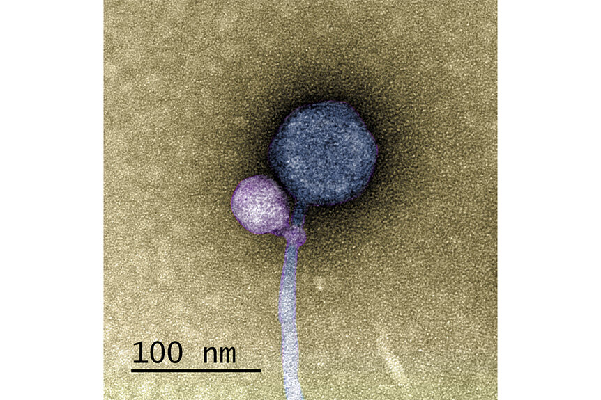 A satellite virus latched onto its helper virus.