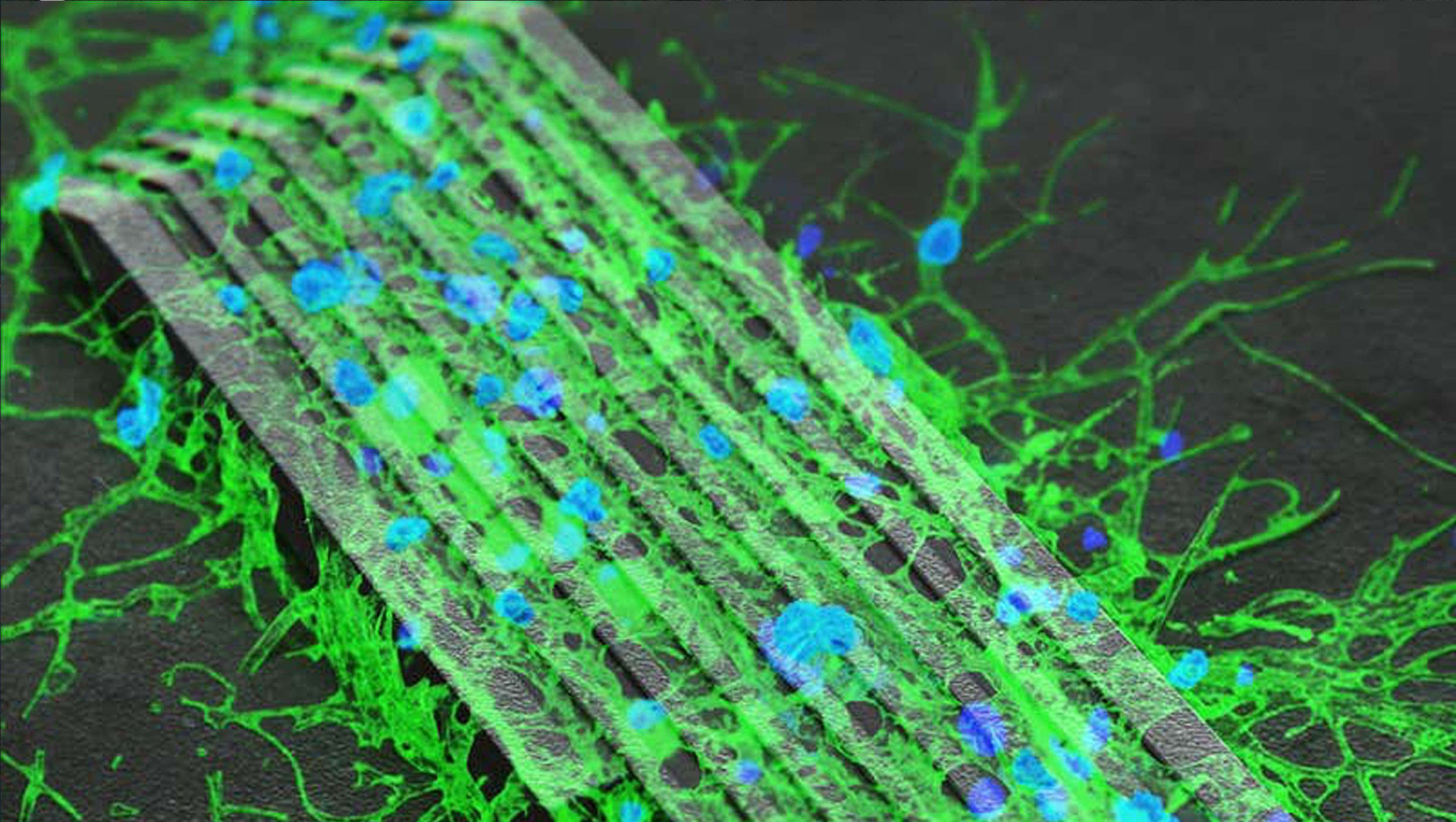 neurons growing over magnetic micro-bots