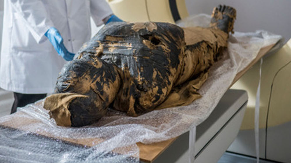 Pregnant mummy reveals fetus that wasn’t just mummified, but pickled