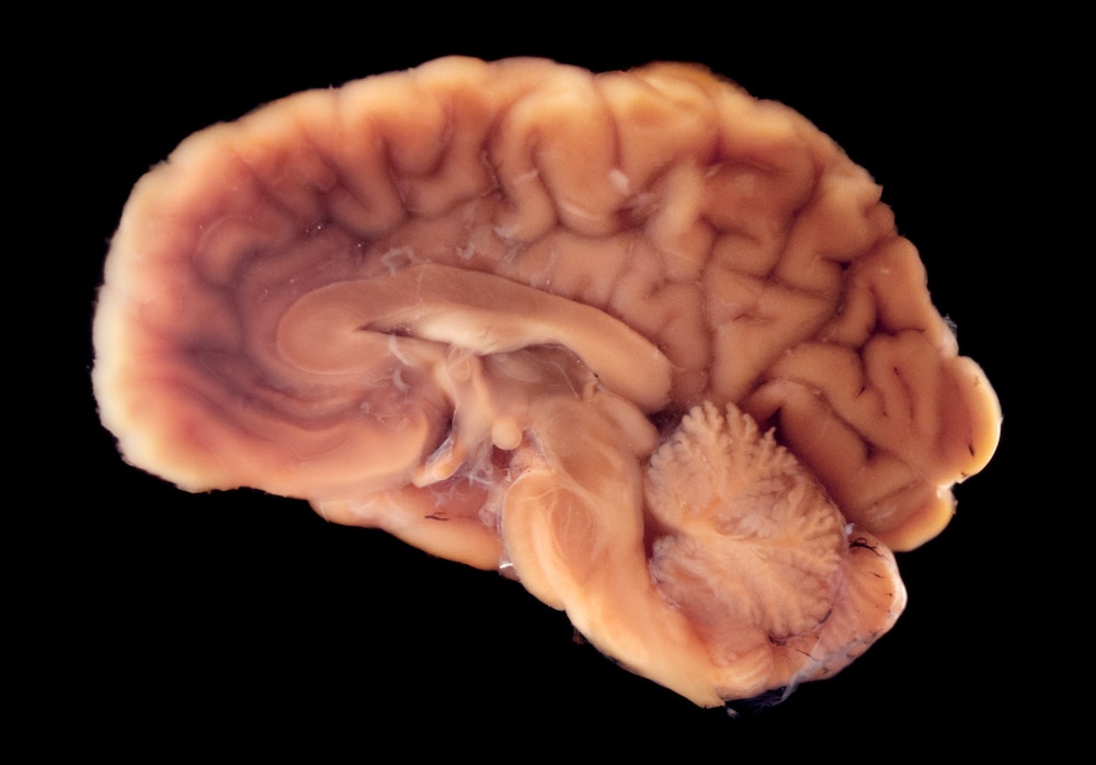 Half of a human brain in black background