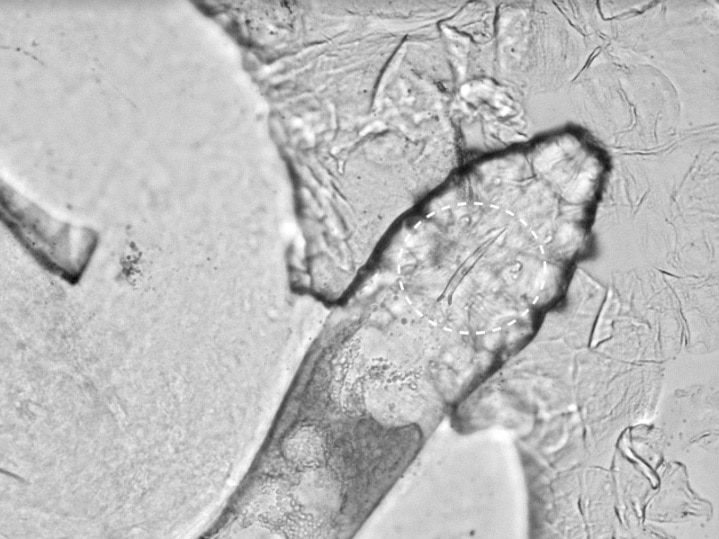 Face Mite Under Microscope