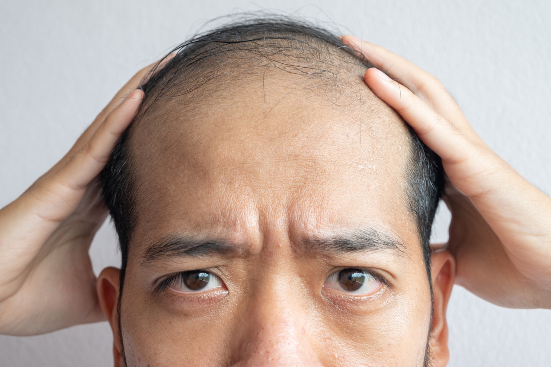 New hair loss treatment designed by artificial intelligence | SYFY WIRE
