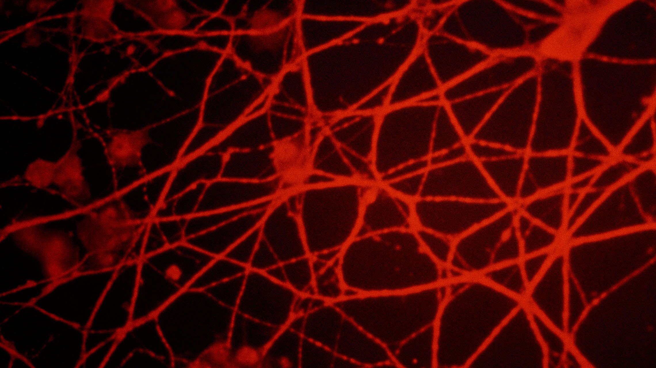 human neurons
