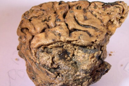 ancient brain