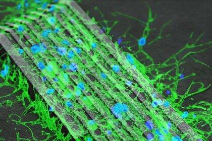neurons growing over magnetic micro-bots