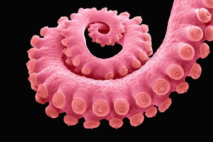 Micrograph of an octopus arm