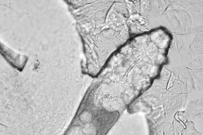Face Mite Under Microscope