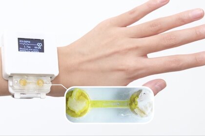 Slime Mold Smart Watch