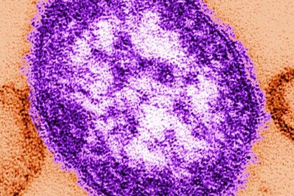 measles_virion.jpg
