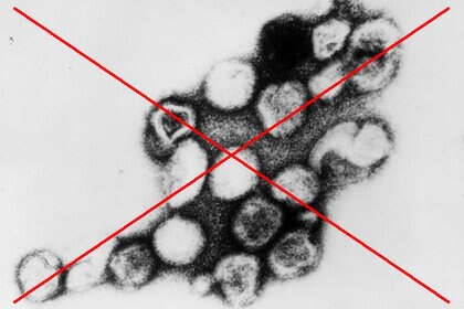 rubella_virus_0.jpg