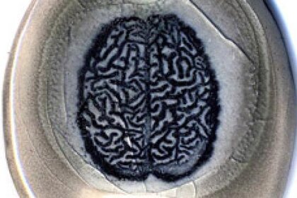 surly_brain.jpg.CROP.rectangle-large.jpg