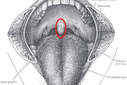 uvula.jpg.CROP.rectangle-large.jpg
