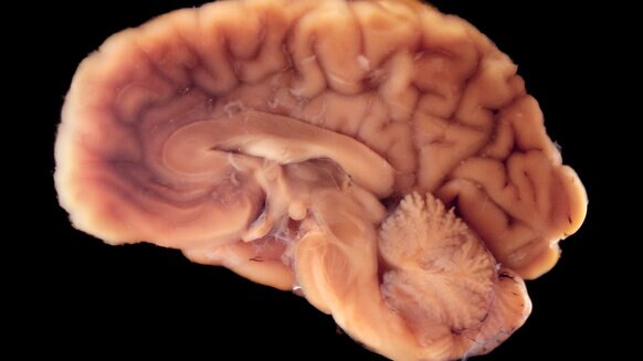 Half of a human brain in black background