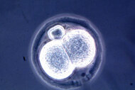 Microscopic View Of A Two Cell Mouse Embryo