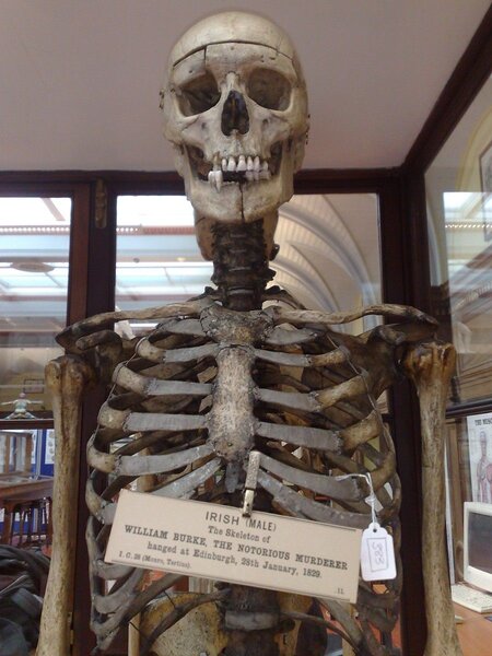 Burke Skeleton
