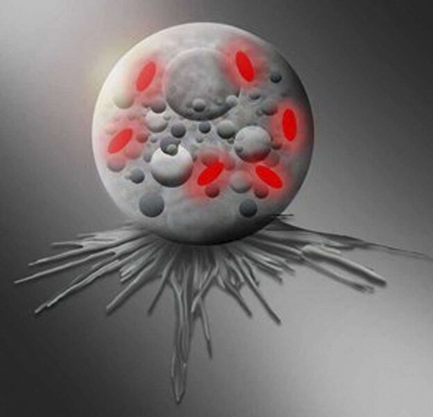 pokemonas bacteria in an amoeba