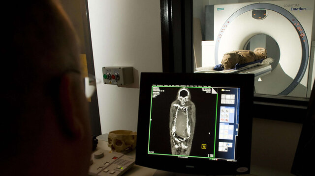 Egyptian mummy being scanned