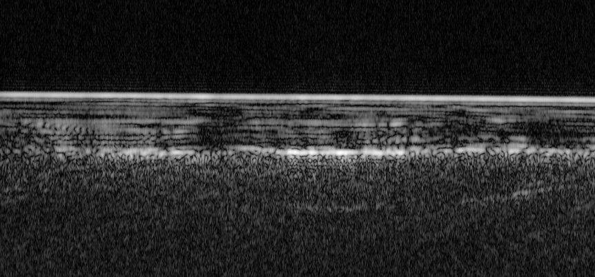 Penetrating radar image of Mars shows the icy surface as a bright fuzzy line at the top, and deeper down (toward the bottom) the patchier, undulating bright line that may be a signal from liquid water. Credit: ESA/NASA/JPL/ASI/Univ. Rome; R. Orosei et al 