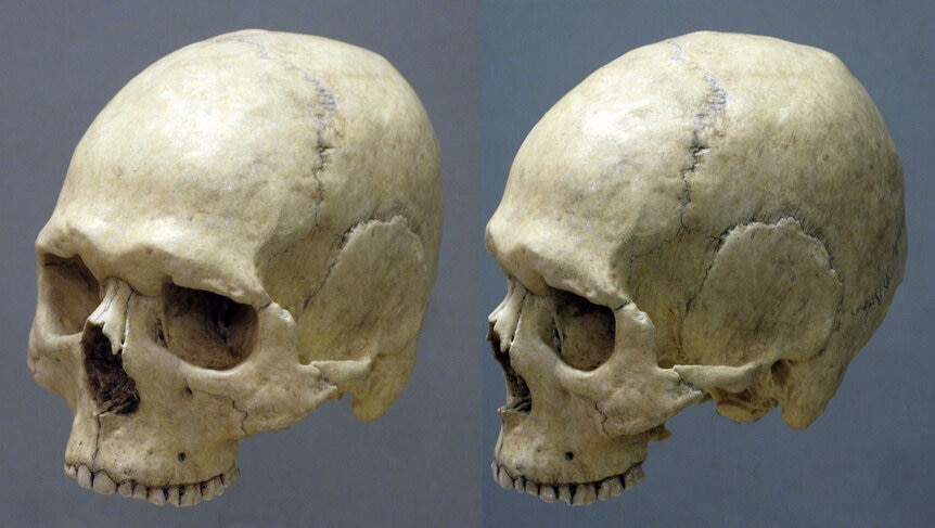 ancient skull