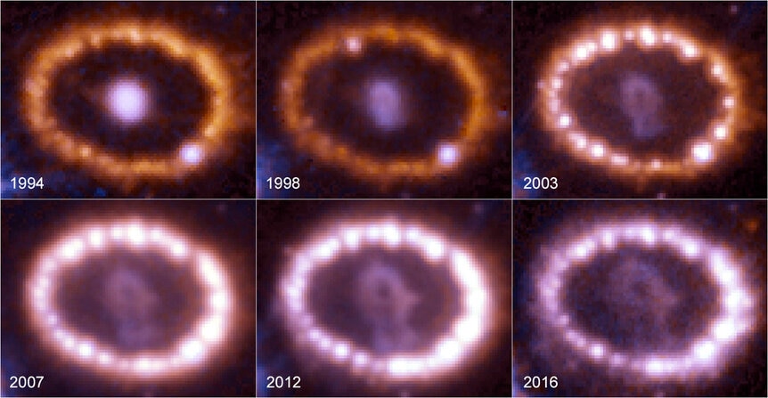 the inner ring of SN87A