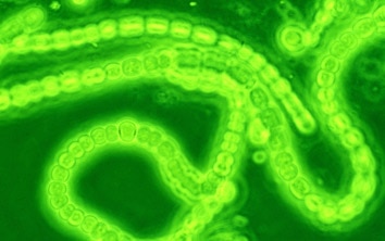 cyanobacteria_354.jpg